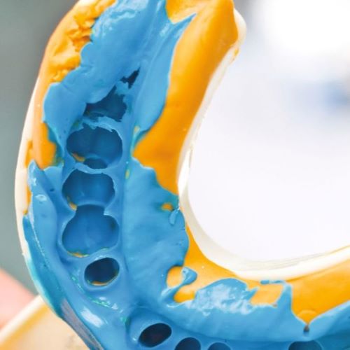 silicone per impronte dentali